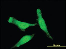 Anti-SMAD7 Mouse Monoclonal Antibody [clone: 3G8]