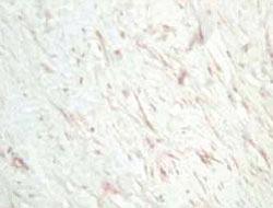 Anti-SFRP1 Rabbit Polyclonal Antibody