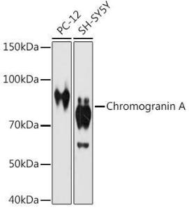 Western blot analysis of extracts of various cell lines, using Anti-Chromogranin A Antibody [ARC1643] (A307702) at 1:1000 dilution. The secondary Antibody was Goat Anti-Rabbit IgG H&L Antibody (HRP) at 1:10000 dilution. Lysates/proteins were present at 25 µg per lane