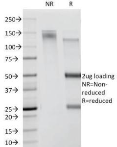 SDS-PAGE analysis of Anti-CDw78 Antibody [DF1588] under non-reduced and reduced conditions; showing intact IgG and intact heavy and light chains, respectively. SDS-PAGE analysis confirms the integrity and purity of the antibody.