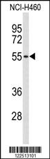 Anti-ASIC2 Rabbit Polyclonal Antibody