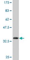 Anti-RXRB Mouse Monoclonal Antibody [clone: 2E6]