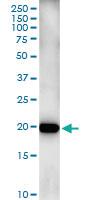 Anti-ISG20 Polyclonal Antibody Pair