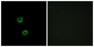 Immunofluorescence analysis of MCF7 cells using Anti-TMEM30C Antibody The right hand panel represents a negative control, where the antibody was pre-incubated with the immunising peptide