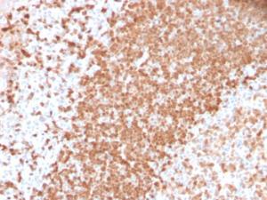 Anti-TCL1 antibody