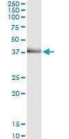 Anti-TRIB2 Antibody Pair