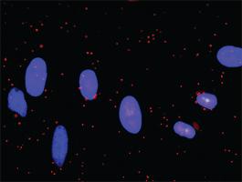 Anti-BCL2L1 + CASP9 Antibody Pair