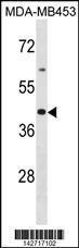 Anti-OR2B6 Rabbit Polyclonal Antibody (HRP (Horseradish Peroxidase))