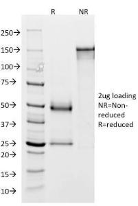 SDS-PAGE analysis of Anti-Glycoprotein 2 Antibody [GP2/1803] under non-reduced and reduced conditions; showing intact IgG and intact heavy and light chains, respectively. SDS-PAGE analysis confirms the integrity and purity of the antibody.