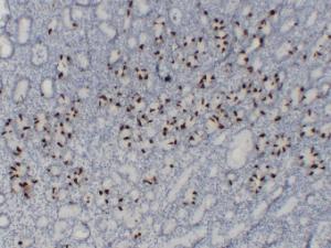 Immunohistochemical analysis of paraffin-embedded human Stomach using Anti-Gastrin Antibody