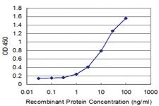 Anti-SMAD7 Mouse Monoclonal Antibody [clone: 1C4]