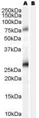 Anti-EBAG9 Antibody (A84223) (0.2 µg/ml) staining of A431 lysate (35 µg protein in RIPA buffer) with (B) and without (A) blocking with the immunising peptide. Primary incubation was 1 hour. Detected by chemiluminescence