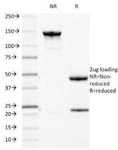 SDS-PAGE analysis of Anti-MUC1 Antibody [HMPV] under non-reduced and reduced conditions; showing intact IgG and intact heavy and light chains, respectively. SDS-PAGE analysis confirms the integrity and purity of the antibody.