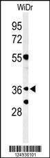 Anti-NSMCE4A Rabbit Polyclonal Antibody