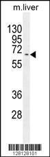 Anti-KY Rabbit Polyclonal Antibody (HRP (Horseradish Peroxidase))