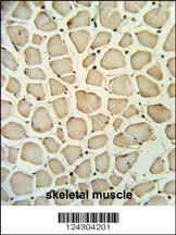 Anti-PGP Rabbit Polyclonal Antibody (FITC (Fluorescein Isothiocyanate))