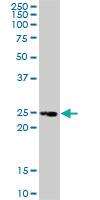 Anti-TNFRSF18 Mouse Monoclonal Antibody [clone: 2H4]