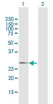 Anti-GALNT12 Rabbit Polyclonal Antibody