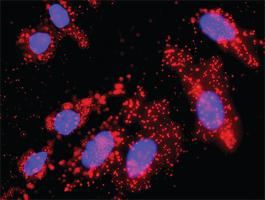 Anti-FGFR1 + SOS1 Antibody Pair