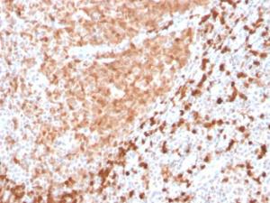 Anti-TCL1 antibody