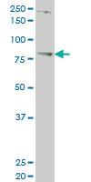 Anti-TBX3 Mouse Monoclonal Antibody [clone: 3A7]