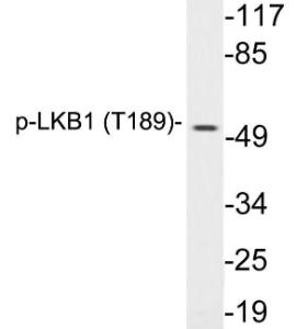 Western blot analysis of lysates from HeLa cells treated with PMA using Anti-LKB1 (phospho Thr189) Antibody