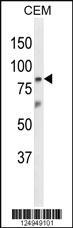 Anti-SMAD9 Rabbit Polyclonal Antibody