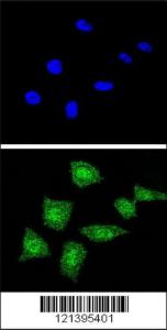 Anti-SOD1 Rabbit Polyclonal Antibody (Biotin)