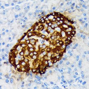 Immunohistochemistry analysis of paraffin-embedded rat pancreatic islet using Anti-Chromogranin A Antibody [ARC1643] (A307702) at a dilution of 1:100 (40X lens). Perform microwave antigen retrieval with 10 mM Tris/EDTA buffer pH 9.0 before commencing with IHC staining protocol