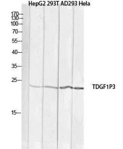 Anti-TDGF1P3 Rabbit Polyclonal Antibody