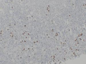 Immunohistochemical analysis of paraffin-embedded human Stomach using Anti-Gastrin Antibody