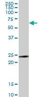 Anti-TNFRSF18 Mouse Monoclonal Antibody [clone: 2H4]