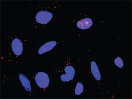 Anti-PDGFRB + PIK3R3 Antibody Pair