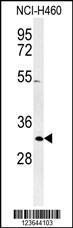 Anti-XPA Rabbit Polyclonal Antibody (AP (Alkaline Phosphatase))