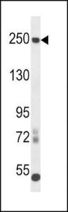 Anti-L1CAM Rabbit Polyclonal Antibody (APC (Allophycocyanin))