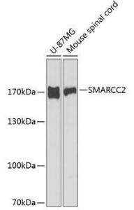 Anti-BAF170 antibody