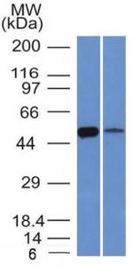 Western blot analysis of K562 cell and lung tissue lysates using Anti-ALDH1A1 Antibody [ALDH1A1/1381]