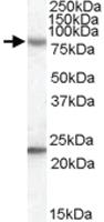 Anti-DHX58 Goat Polyclonal Antibody