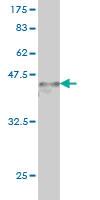 Anti-ARID1B Mouse Monoclonal Antibody [clone: 2D2]