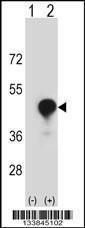 Anti-CD1C Rabbit Polyclonal Antibody (Biotin)