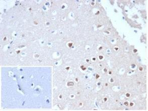 Immunohistochemical analysis of formalin-fixed, paraffin-embedded human cerebellum tissue using Anti-NeuN Antibody [NeuN/288R]. Inset: PBS instead of the primary antibody. Secondary antibody negative control.