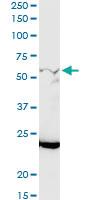 Anti-GALNT12 Rabbit Polyclonal Antibody