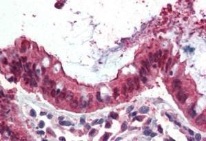 Anti-EZRIN Antibody (A84228) (3.75 µg/ml) staining of paraffin embedded Human Colon. Steamed antigen retrieval with citrate buffer pH 6, AP-staining