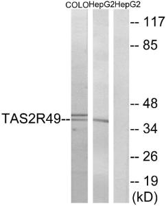 Anti-TAS2R49 Rabbit Polyclonal Antibody