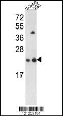 Anti-BTK Rabbit Polyclonal Antibody