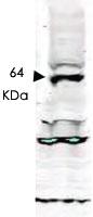 Anti-TLK1 Rabbit Polyclonal Antibody