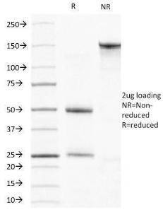 SDS-PAGE analysis of Anti-Muscle Actin Antibody [HHF35] under non-reduced and reduced conditions; showing intact IgG and intact heavy and light chains, respectively. SDS-PAGE analysis confirms the integrity and purity of the antibody