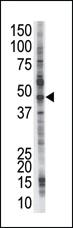 Anti-PSMD4 Rabbit Polyclonal Antibody