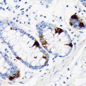 Immunohistochemistry analysis of paraffin-embedded human colon tissue using Anti-Chromogranin A Antibody [ARC1643] (A307702) at a dilution of 1:100 (40X lens). Perform microwave antigen retrieval with 10 mM Tris/EDTA buffer pH 9.0 before commencing with IHC staining protocol