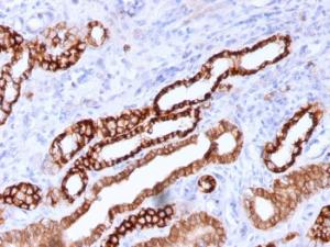 Immunohistochemical analysis of formalin-fixed, paraffin-embedded human kidney using Anti-Cadherin 16 Antibody [CDH16/1071]